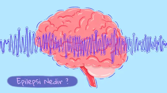 Epilepsi Nedir? Epilepsinin Nörobiyolojisi